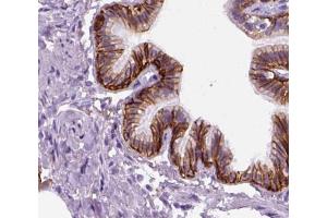 ABIN6268770 at 1/100 staining Human lung tissue by IHC-P. (AQP3 anticorps  (Internal Region))