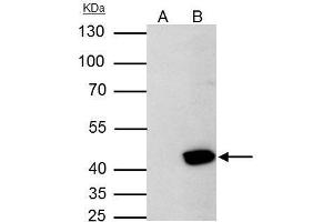 IP Image Aurora A antibody [C3], C-term immunoprecipitates Aurora A protein in IP experiments.