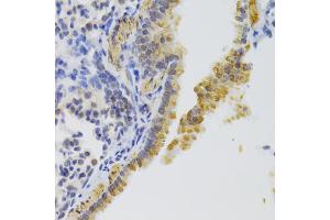 Immunohistochemistry of paraffin-embedded mouse lung using KIF1B Antibody (ABIN5973994) at dilution of 1/100 (40x lens). (KIF1B anticorps)