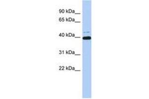 Image no. 1 for anti-MYC-Associated Zinc Finger Protein (Purine-Binding Transcription Factor) (MAZ) (AA 179-228) antibody (ABIN6742437) (MAZ anticorps  (AA 179-228))