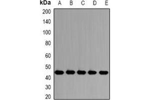 Western blot analysis of PSMD13 expression in HepG2 (A), Jurkat (B), SW620 (C), mouse testis (D), rat lung (E) whole cell lysates. (PSMD13 anticorps)