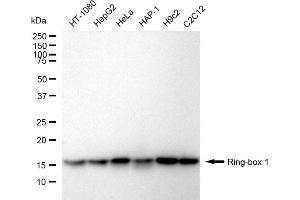 Western blotting analysis using Ring-box 1 antibody (ABIN7800254).