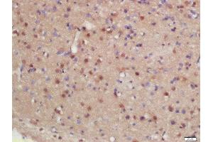 Formalin-fixed and paraffin embedded rat brain labeled with Rabbit Anti-hHR23b Polyclonal Antibody, Unconjugated (ABIN2175752) at 1:200 followed by conjugation to the secondary antibody and DAB staining (RAD23B anticorps  (AA 24-120))