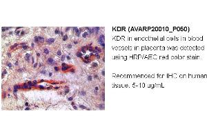 Image no. 1 for anti-VEGF Receptor 2 (VEGFR2) (N-Term) antibody (ABIN504629) (VEGFR2/CD309 anticorps  (N-Term))