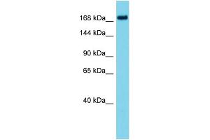 Host: Rabbit Target Name: ATAD2B Sample Type: HT1080 Whole Cell lysates Antibody Dilution: 1.