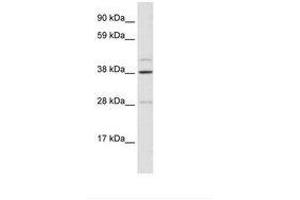Image no. 1 for anti-Ceramide Synthase 3 (CERS3) (AA 54-103) antibody (ABIN6735903) (LASS3 anticorps  (AA 54-103))