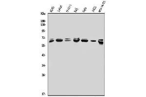 Western blot analysis of MBD4/MED1 using anti-MBD4/MED1 antibody (ABIN7600185).