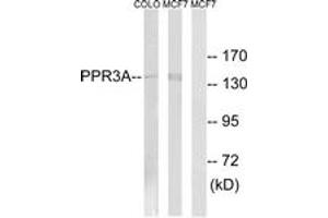 Western blot analysis of extracts from MCF-7/COLO cells, using PPP1R3A Antibody. (PPP1R3A anticorps  (AA 647-696))