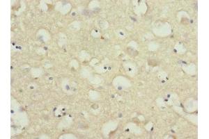 Immunohistochemistry of paraffin-embedded human brain tissue using ABIN7161221 at dilution of 1:100 (Neurexin 3 anticorps  (AA 1584-1643))