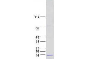 Validation with Western Blot