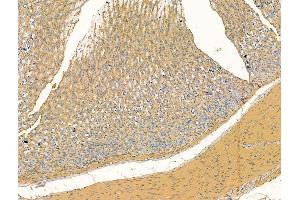 ABIN7094497 and ABIN7098546 at 1/100 staining Rat stomach tissue by IHC-P. (Bestrophin 2 anticorps  (C-Term))