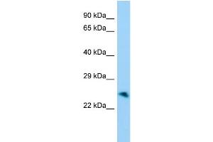 Host:  Rabbit  Target Name:  Unkl  Sample Type:  Mouse Stomach lysates  Antibody Dilution:  1. (UNKL anticorps  (Middle Region))