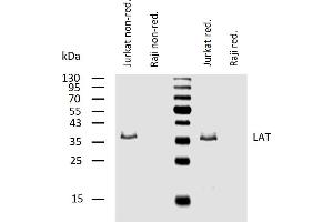 Western blotting analysis of human LAT using mouse monoclonal antibody LAT-01 in lysates of Jurkat cells (positive) and Raji cells (negative control) under non-reducing and reducing conditions.