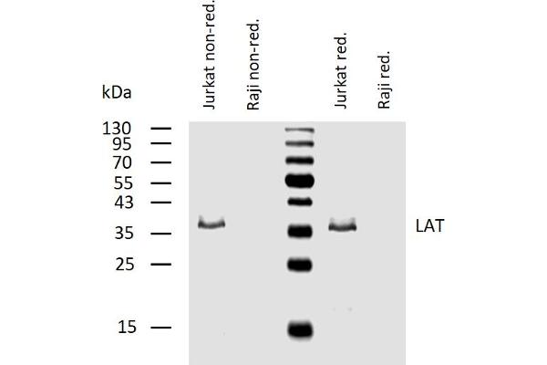 LAT anticorps  (Cytoplasmic Domain)