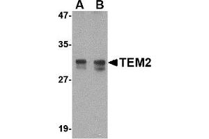 Western Blotting (WB) image for anti-RASD Family, Member 2 (RASD2) (N-Term) antibody (ABIN1031610) (RASD2 anticorps  (N-Term))