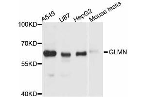Western blot analysis of extracts of various cell lines, using GLMN antibody (ABIN6291150) at 1:3000 dilution. (GLMN anticorps)