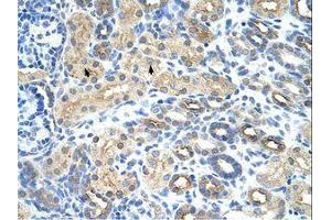 Image no. 1 for anti-U11/U12 SnRNP 35 KDa Protein (AA 29-78) antibody (ABIN203037)