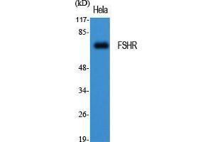 Western Blot (WB) analysis of specific cells using FSHR Polyclonal Antibody. (FSHR anticorps  (Internal Region))