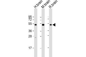 All lanes : Anti-NPTX1- Antibody at 1:2000 dilution Lane 1: human brain lysate Lane 2: mouse brain lysate Lane 3: rat brain lysate Lysates/proteins at 20 μg per lane.