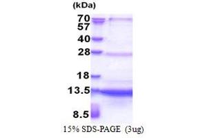 SDS-PAGE (SDS) image for Sec61 beta Subunit (SEC61B) (AA 1-70) protein (His tag) (ABIN6387342) (SEC61B Protein (AA 1-70) (His tag))