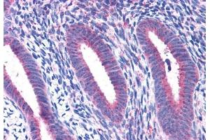 ABIN238580 (3. (RPL22 anticorps  (C-Term))