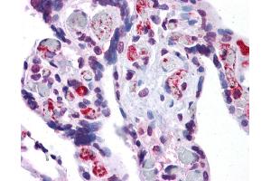 AIFM2 antibody was used for immunohistochemistry at a concentration of 4-8 ug/ml.