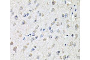Immunohistochemistry of paraffin-embedded Mouse brain using CHCHD3 Polyclonal Antibody at dilution of 1:100 (40x lens). (CHCHD3 anticorps)