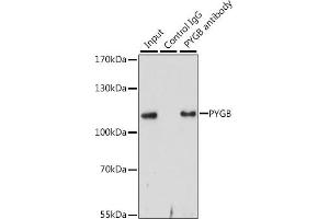 Immunoprecipitation analysis of 200 μg extracts of HepG2 cells, using 3 μg PYGB antibody .