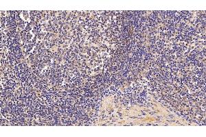 Detection of TBG in Porcine Lymph node Tissue using Polyclonal Antibody to Thyroxine Binding Globulin (TBG)