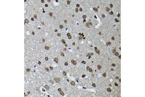 Immunohistochemistry of paraffin-embedded rat brain using Cyclin K Rabbit pAb (ABIN6128996, ABIN6138098, ABIN6138099 and ABIN6214445) at dilution of 1:100 (40x lens). (Cyclin K anticorps  (AA 1-160))