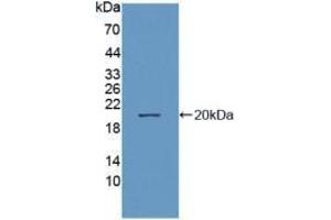 Western blot analysis of recombinant Human NEP. (MME anticorps  (AA 382-538))