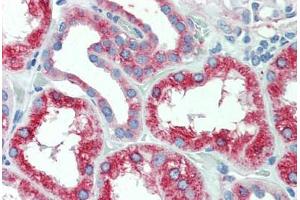 Anti-SLC11A2 antibody  ABIN1049329 IHC staining of human, kidney.
