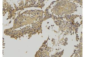 ABIN6276902 at 1/100 staining RAT testis tissue by IHC-P. (HSD3B2 anticorps)