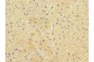 Immunohistochemistry analysis of paraffin-embedded human adrenal gland tissue using IFNLR1 antibody at a dilution of 1/100. (IL28RA anticorps  (AA 21-228))