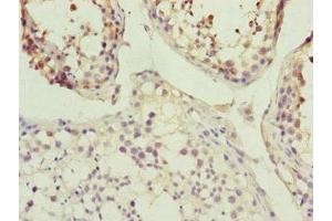 Immunohistochemistry of paraffin-embedded human testis tissue using ABIN7157235 at dilution of 1:100 (KANSL3 anticorps  (AA 1-200))