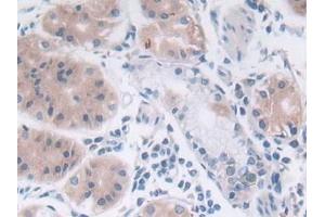 Detection of SRY in Human Stomach Tissue using Polyclonal Antibody to Sex Determining Region Y (SRY) (SRY anticorps  (AA 1-204))