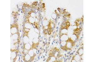 Immunohistochemistry of paraffin-embedded Human rectum using MYO5A Polyclonal Antibody at dilution of 1:100 (40x lens). (MYO5A anticorps)