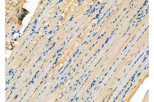 ABIN6260446 and ABIN6276575 at 1/100 staining Rat muscle tissue by IHC-P.