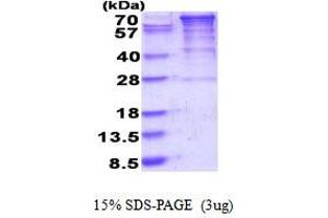 SDS-PAGE (SDS) image for Eukaryotic Elongation Factor-2 Kinase (EEF2K) (AA 1-725) protein (His tag) (ABIN6387490) (EEF2K Protein (AA 1-725) (His tag))