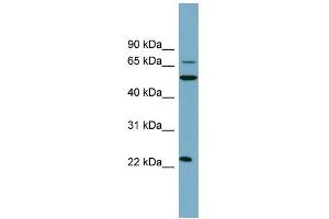 WB Suggested Anti-CLEC6A Antibody Titration:  0. (C-Type Lectin Domain Family 6, Member A (CLEC6A) (N-Term) anticorps)
