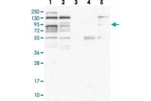 Western blot analysis of Lane 1: RT-4, Lane 2: U-251 MG, Lane 3: Human Plasma, Lane 4: Liver, Lane 5: Tonsil with ZNF227 polyclonal antibody  at 1:100-1:250 dilution. (ZNF227 anticorps)
