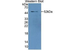 Detection of Recombinant LMNA, Human using Polyclonal Antibody to Lamin A/C (LMNA)