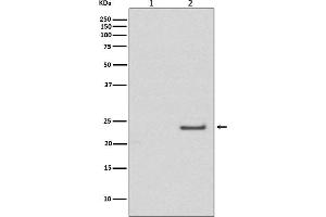 Western blot analysis of Phospho-Rac1/Cdc42 (Ser71) expression in (1) A431 cell lysate treated with LP, (2) A431 cell lysate.