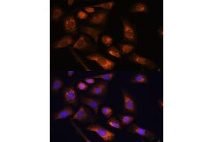 Immunofluorescence analysis of U-2 OS cells using RPS13 antibody (ABIN7270012) at dilution of 1:100.