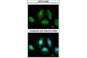 Image no. 2 for anti-Inhibitor of kappa Light Polypeptide Gene Enhancer in B-Cells, Kinase epsilon (IKBKE) (AA 544-680) antibody (ABIN467546)