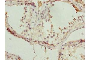 Immunohistochemistry of paraffin-embedded human testis tissue using ABIN7171567 at dilution of 1:100 (TBPL1 anticorps  (AA 1-186))