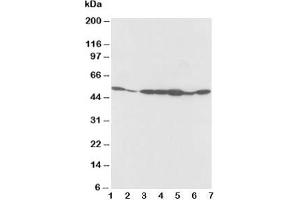 Western blot testing of alpha 2a Adrenergic Receptor antibody and Lane 1:  rat testis;  2: rat brain;  3: MCF-7;  4: MM453;  5: SMMC-7721;  6: HeLa;  7: COLO320 cell lysate (ADRA2A anticorps  (C-Term))
