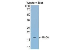 Western Blotting (WB) image for anti-Cartilage Oligomeric Matrix Protein (COMP) (AA 40-180) antibody (ABIN1858468)