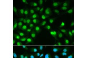 Immunofluorescence analysis of HeLa cells using PPP3CA Polyclonal Antibody (PPP3CA anticorps)