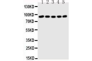 Western Blotting (WB) image for anti-Signal Transducer and Activator of Transcription 1, 91kDa (STAT1) (AA 736-750), (C-Term) antibody (ABIN3043178)